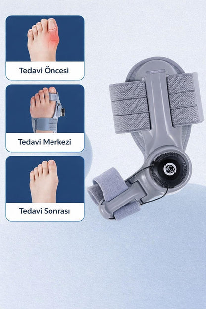 LaraL Ayarlanabilir Halluks Valgus Desteği